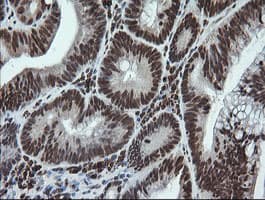 LMO2 Antibody (clone OTI1G10)