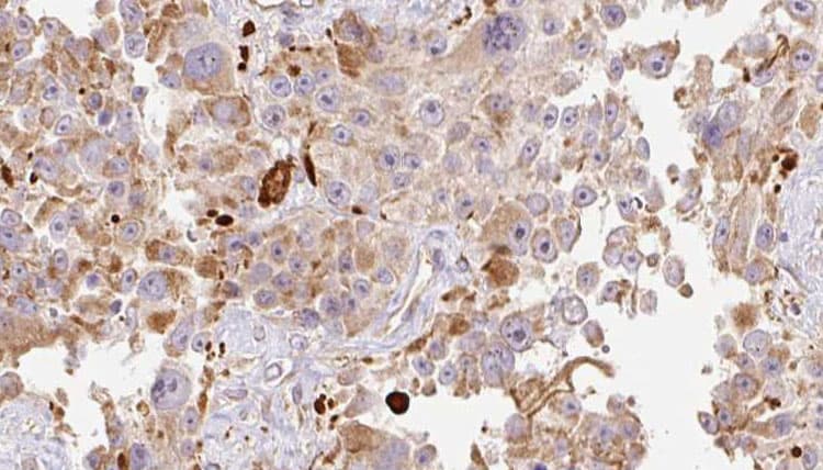 Polyclonal Rabbit anti-Human HAPLN1 Antibody (IHC, IF, WB)