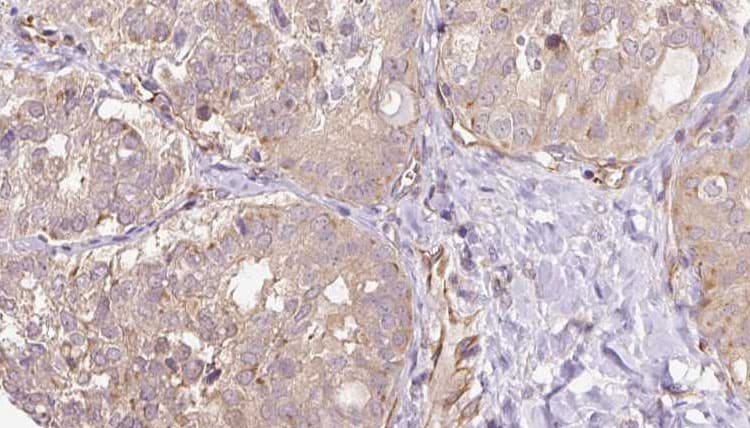 SGCG / Gamma-Sarcoglycan Antibody