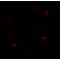 B9D1 Antibody