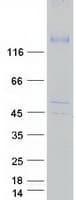 Human WC1 / ATP7B Protein (Recombinant Myc-DDK (Flag))