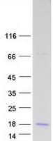 Human GNRH2 Protein (Recombinant Myc-DDK (Flag))