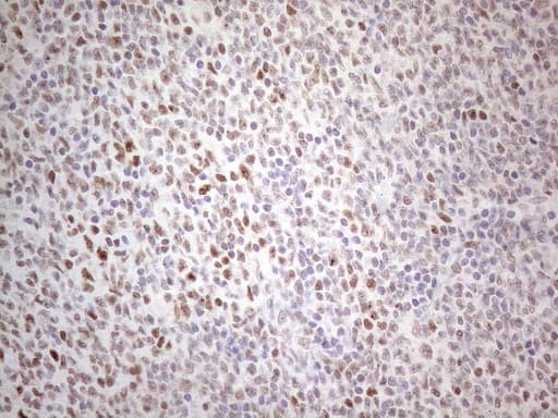 TDG / Thymine DNA Glycosylase Antibody (aa160-253, clone OTI3C11)