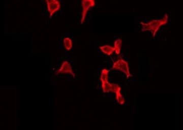 CTTN / Cortactin Antibody (phospho-Tyr421)