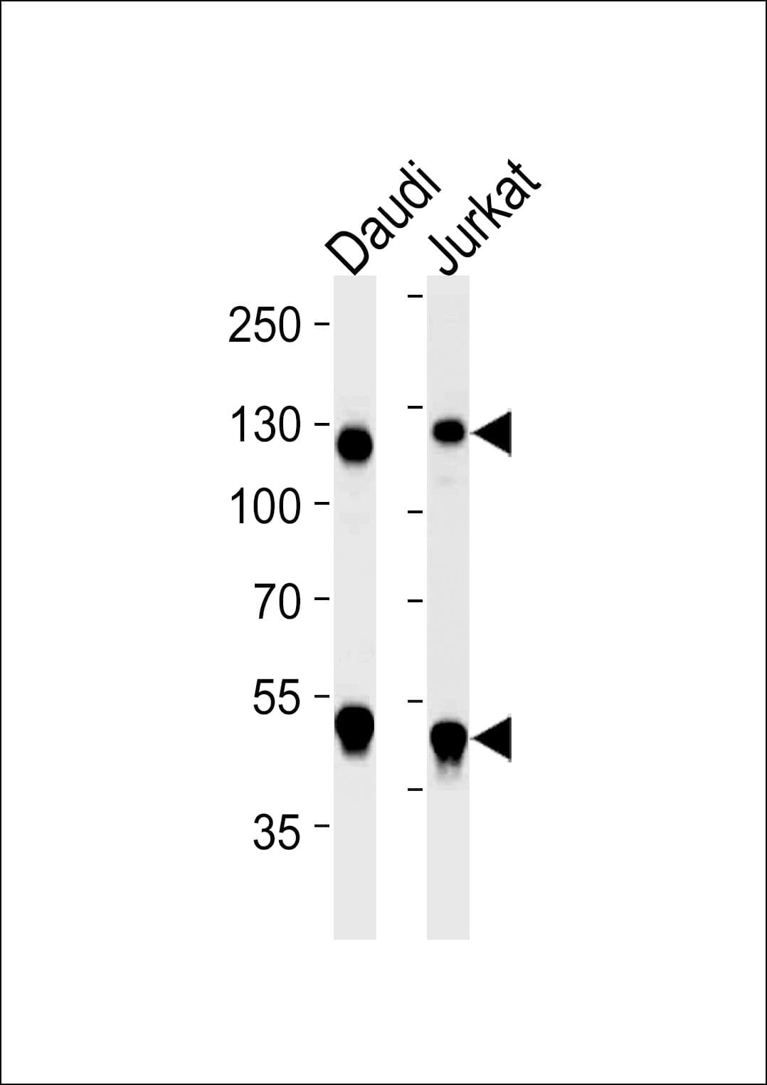 NFKB1 / NF-Kappa-B Antibody (clone 1298CT792.105.117.133)