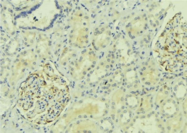 ADGRF1 / GPR110 Antibody