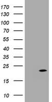 CDKN2C / p18 INK4c Antibody (clone OTI2E1)