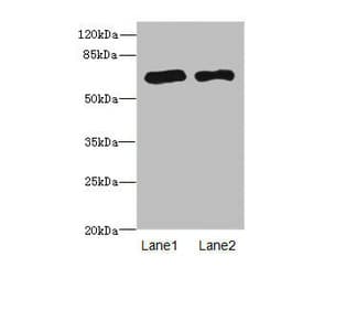 Polyclonal Rabbit anti-Human PPM1D / WIP1 Antibody (IHC, WB)