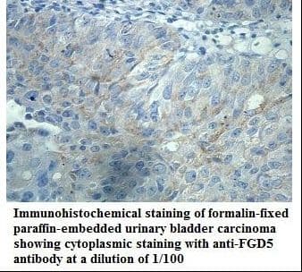 FGD5 Antibody (aa391-540)