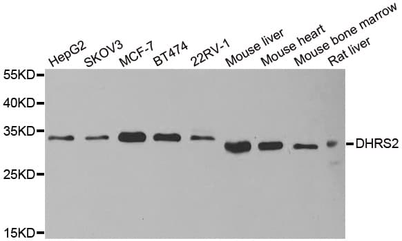 DHRS2 / HEP27 Antibody