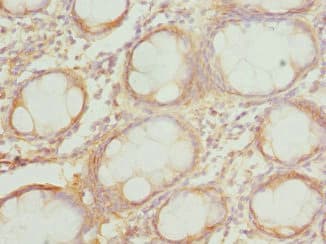 Polyclonal Rabbit anti-Human COX10 Antibody (IHC)