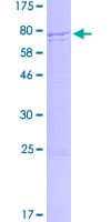 Human ERVFRD-1 / HERV-FRD Protein (Recombinant GST)