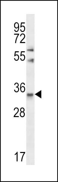 Polyclonal Rabbit anti-Human CELA3A / ELA3 Antibody (aa157-186, IHC, WB)