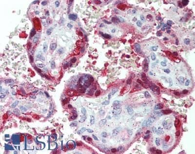 IHC-plus™ Polyclonal Rabbit anti-Human PNP / Nucleoside Phosphorylase Antibody (aa239-289, IHC, WB)