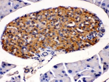 HSD2 / HSD11B2 Antibody