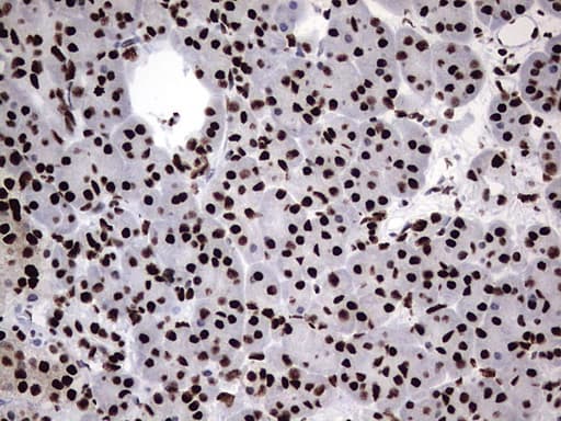 HNRPM / HNRNPM Antibody (aa1-261, clone OTI4C9)