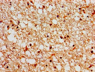 Polyclonal Rabbit anti-Human SH3TC2 Antibody (IHC, IF)