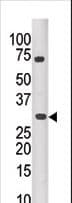 IHC-plus™ PIM3 / PIM-3 Antibody (aa259-288)