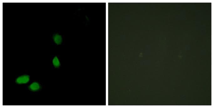 Polyclonal Rabbit anti-Human HMGN2 Antibody (IHC, IF)