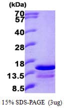 Human GHRL / Ghrelin Preproprotein (Recombinant His)