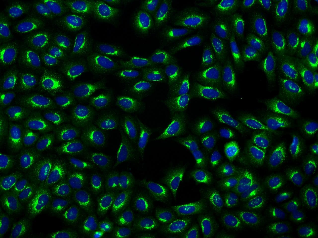 COPG / Gamma-COP Antibody