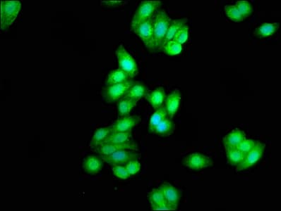 Polyclonal Rabbit anti-Human CSNK1D Antibody (IHC)