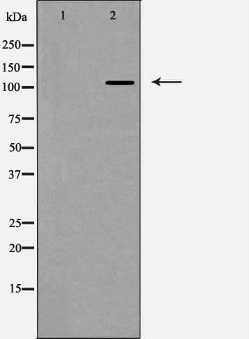 ITGAV/Integrin Alpha V/CD51 Antibody