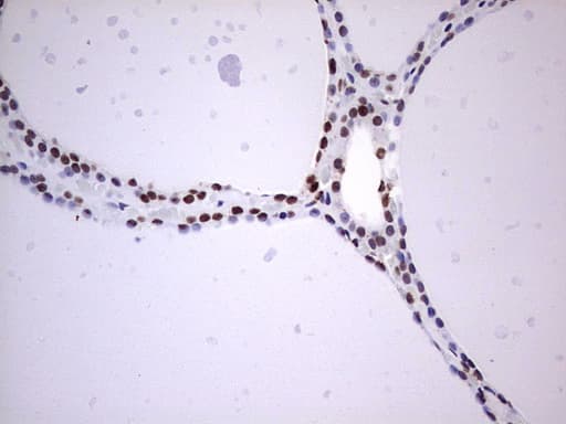 MYF5 / MYF 5 Antibody (clone OTI2G5)