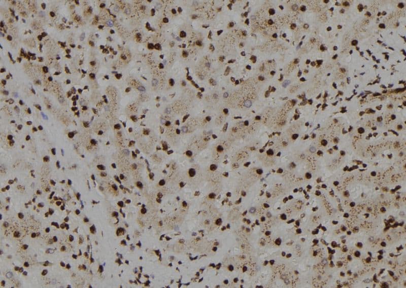 Polyclonal Rabbit anti-Human CRTR1 / TFCP2L1 Antibody (IHC, WB)