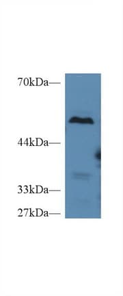 CPB2 / TAFI Antibody (aa113-422)
