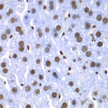 Polyclonal Rabbit anti-Human SF3B2 Antibody (IHC, IF, WB)