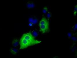 IGF2BP2 Antibody (clone OTI3G7)