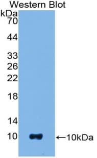 S100B / S100 Beta Antibody (aa1-92)