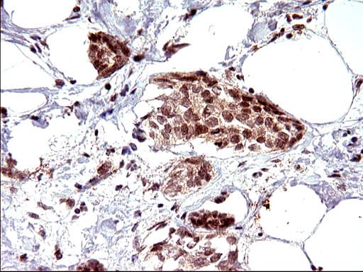 NDN / Necdin Antibody (clone OTI5D1)