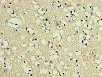 Polyclonal Rabbit anti-Human PNMA5 Antibody (WB)