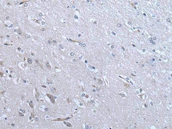 PARP13 / ZC3HAV1 Antibody