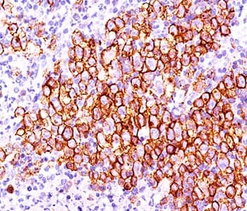 CD30 Antibody (clone CD30/412)