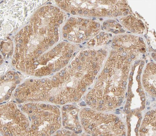 PTPN11 / SHP-2 / NS1 Antibody (phospho-Tyr580)