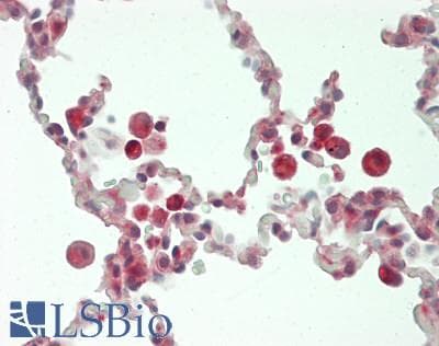 CHI3L1 / YKL-40 Antibody (aa112-377)
