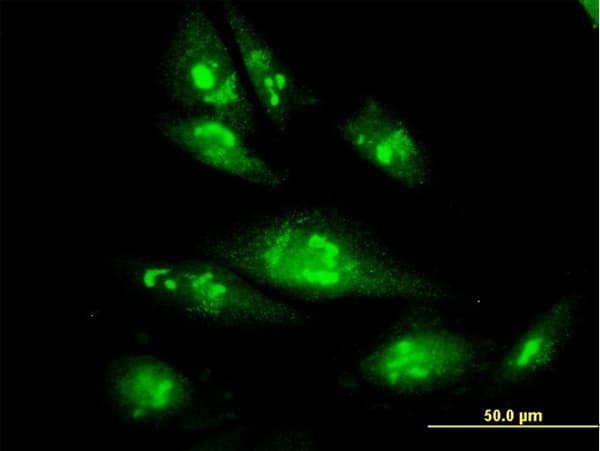 Monoclonal Mouse anti-Human PSMC4 Antibody (clone 3G8, IF, WB)