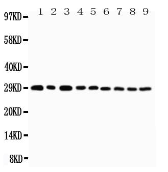 Polyclonal Rabbit anti-Human TNFRSF4 / CD134 / OX40 Antibody (aa29-47, WB)