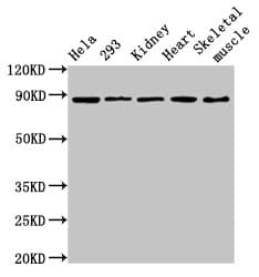SEMA3A / Semaphorin 3A Antibody