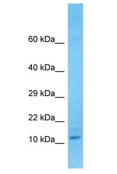 TMEM105 Antibody (aa27-76)
