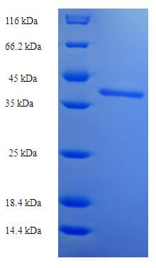 Human BTN2A2 Protein (Recombinant His-SUMO)