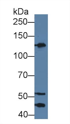KNG1 / Kininogen / Bradykinin Antibody (aa390-644, Cy3)