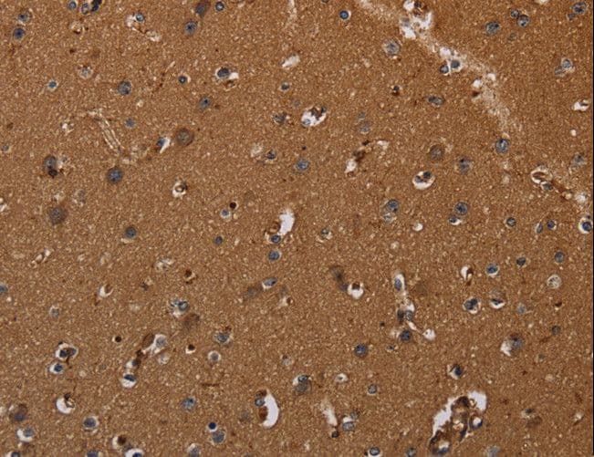CYBB / NOX2 / gp91phox Antibody