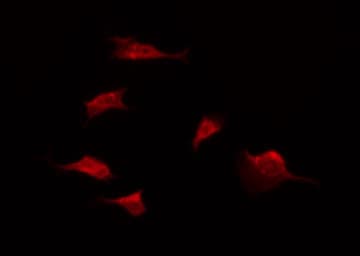 Polyclonal Rabbit anti-Human CDH17 / Cadherin 17 Antibody (aa355-378, IF, WB)
