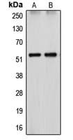 CYP26 / CYP26A1 Antibody (Internal)