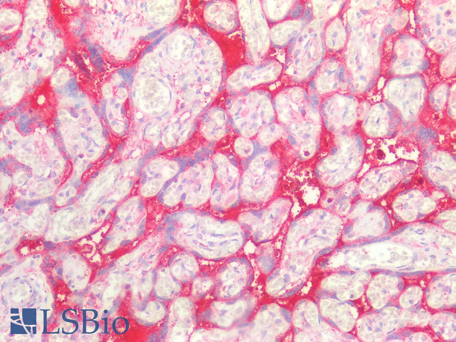 IHC-plus™ SDC1 / Syndecan 1 / CD138 Antibody (aa25-240)
