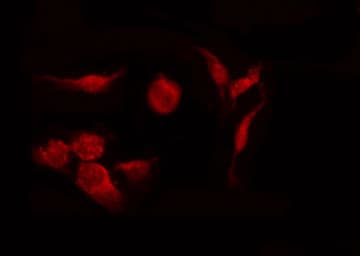 Polyclonal Rabbit anti-Human CDK5R1 Antibody (IF, WB)